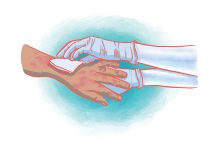 Burns burns caused by heat