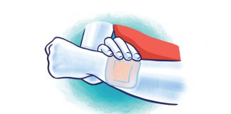 Cuts and scrapes cuts and scrapes - caymanhealth