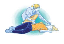 Seizures (convulsions) seizure