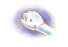 Blisters blisters - caymanhealth