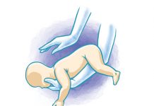 Conscious infant choking infant choking