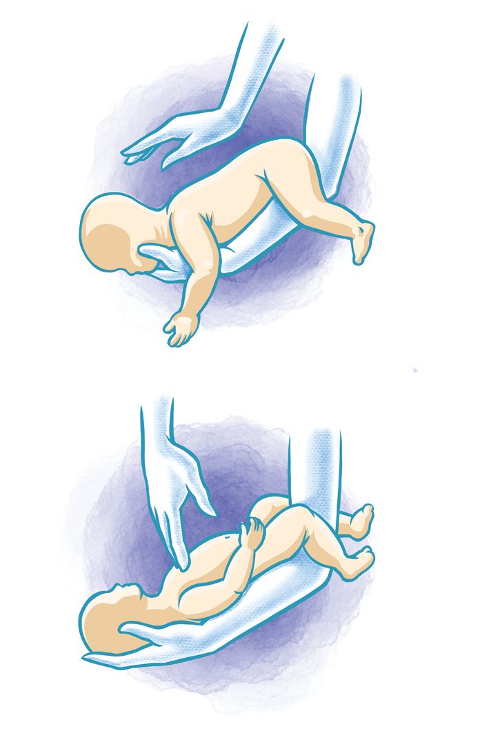 infant choking