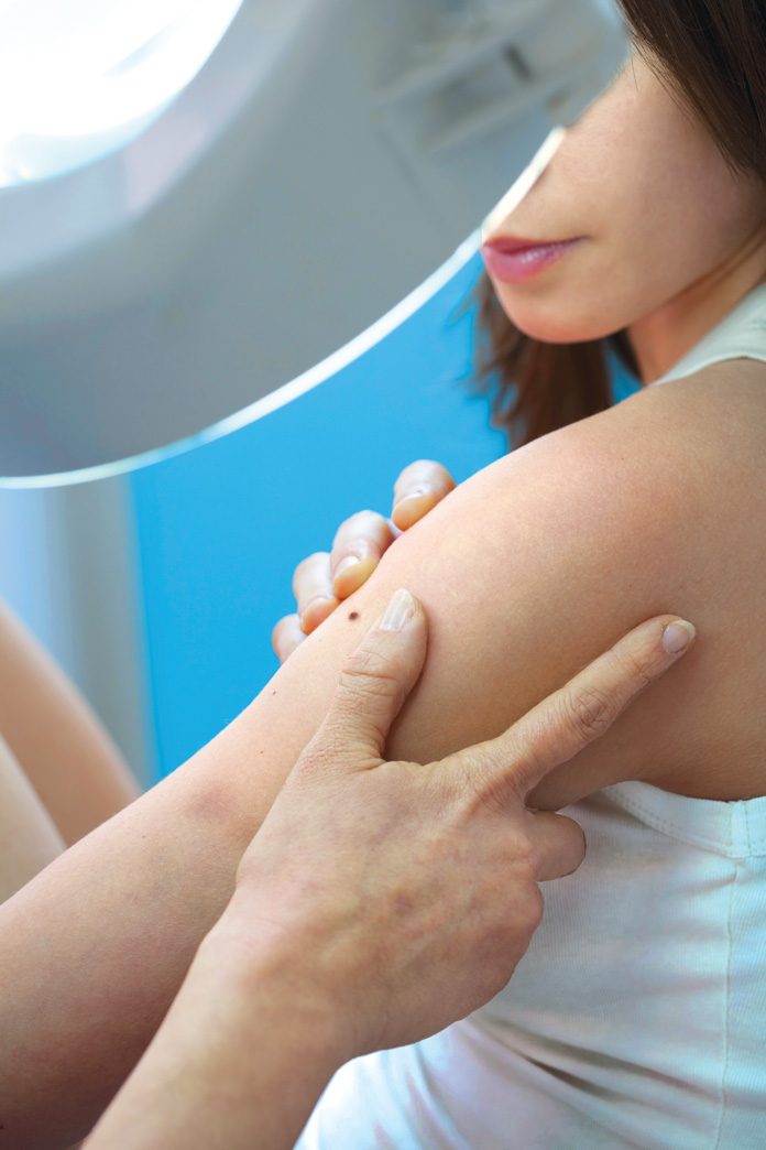 skin cancer - caymanhealth